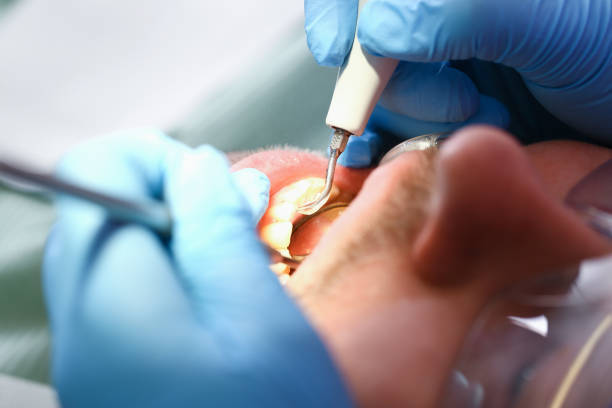 Best Cosmetic Emergency Dentistry in Hlsboro, IL