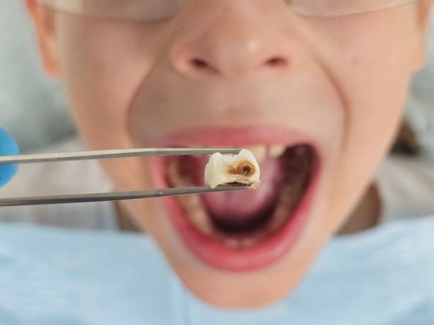 Best Same-Day Emergency Dental Services in Hlsboro, IL
